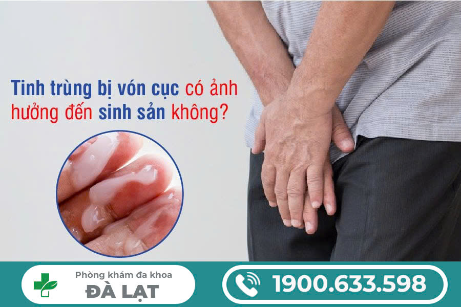 Hình ảnh minh họa